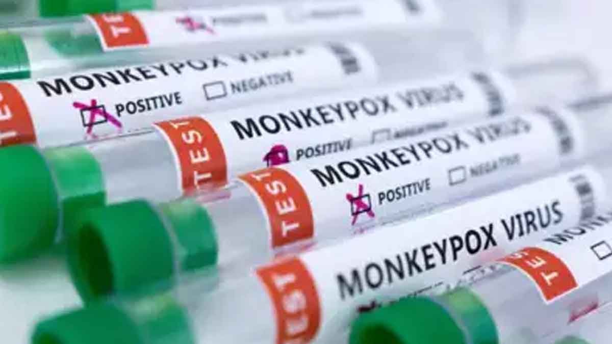 Monkeypox-Virus