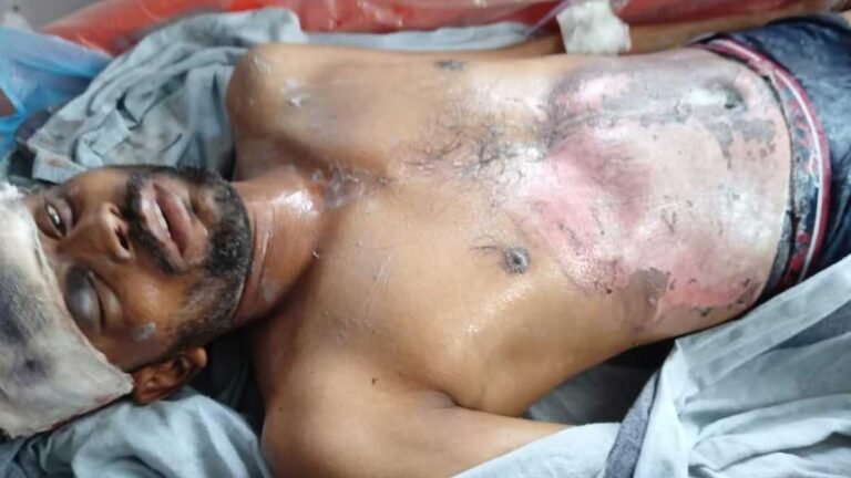 सिवनी: MP के CM शिवराज सिंह के कार्यक्रम के दौरान करेंट लगने से विद्युतकर्मी की मौत
