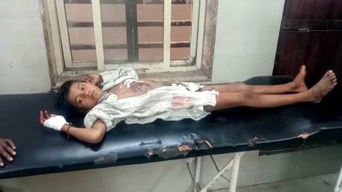 Mobile-Battery-Blast