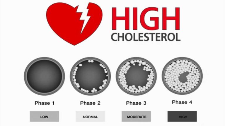 High cholesterol: कोलेस्ट्रॉल के लेवल को कंट्रोल करना चाहते हैं ? तो ऐसे करें सुबह की शुरुआत