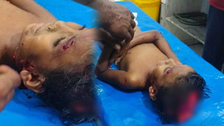 सिवनी: दर्दनाक हादसे का शिकार हुई 5वीं की छात्रा, कुत्तों के झुंड ने सिर की चमड़ी उधेड़ी; कमजोर दिल वाले तस्वीरें ना देखें