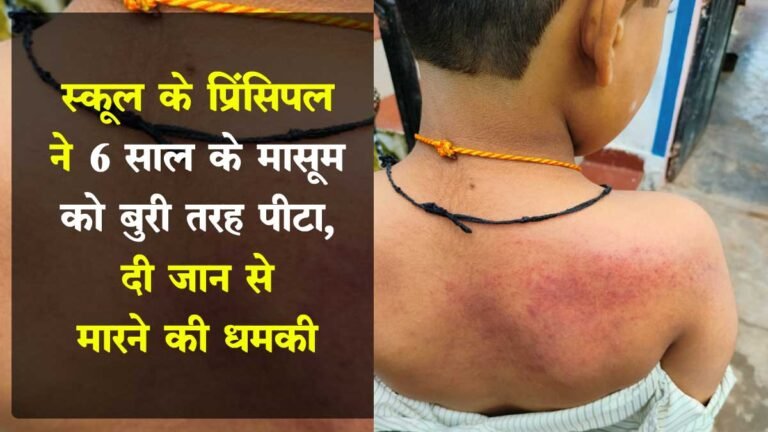 सिवनी: 6 साल के मासूम को प्रिंसिपल ने पीटा, दी जान से मारने की धमकी, Vidya Bhumi City Pride School Barghat का मामला