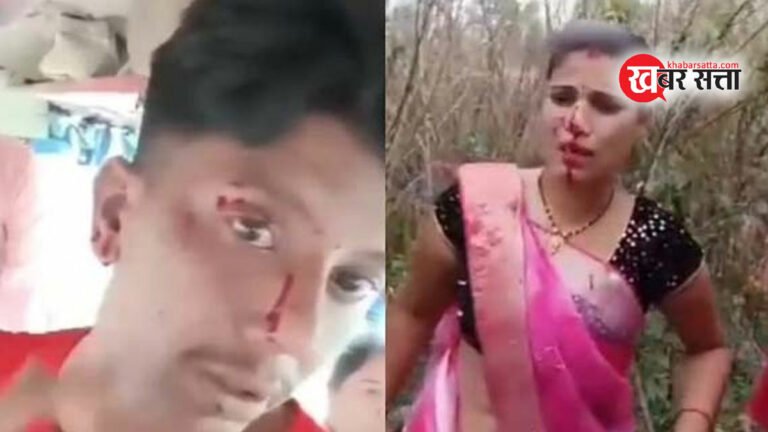 सिवनी से जबलपुर जा रही यात्री बस और कंटेनर की टक्कर से 06 व्यक्ति घायल