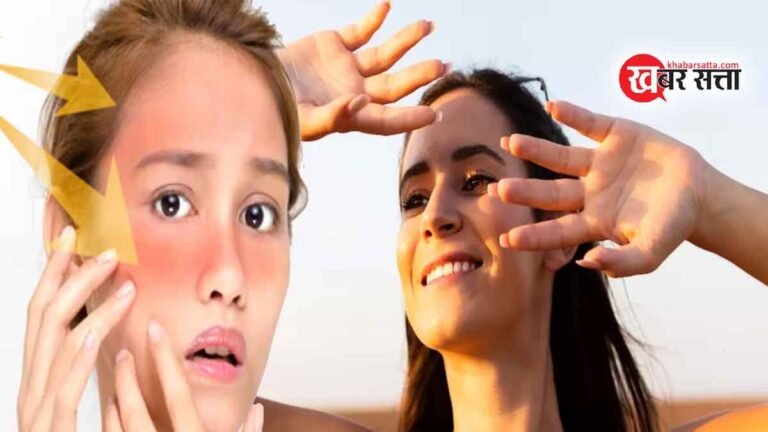 सनबर्न और टैन लाइन्स से इस चिलचिलाती गर्मी में अपने आप को कैसे बचाएं? जानिए आसान भाषा में