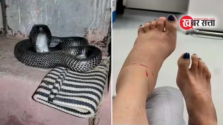 महिला को सांप ने काटा: परिवार ने सांप और महिला दोनों को इलाज के लिए अस्पताल पहुंचाया!