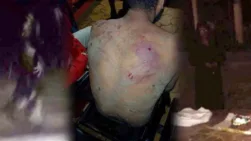 चुड़ैल का हमला या अफवाह? सिवनी के 'जनता नगर' में वायरल VIDEO ने मचाया तहलका, खबर सत्ता की FACT CHECK में निकली सच्चाई कुछ और ही!