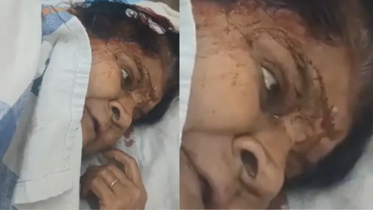 सिवनी: कटंगी नाका में दिल दहला देने वाली वारदात, महिला के घर चोरी और हथौड़े से हमला