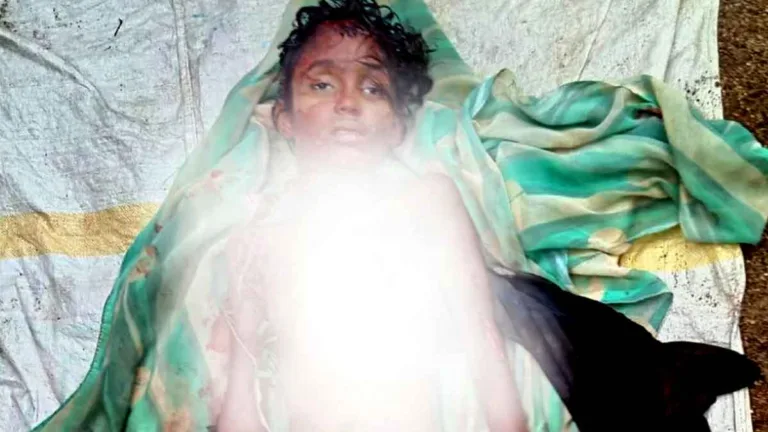 सिवनी जिले में दिल दहला देने वाली घटना, 13 वर्षीय बच्ची बनी आवारा कुत्तों का शिकार